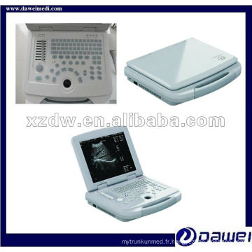 Chine kit gynécologique de système de scanner d&#39;échographie humaine d&#39;ordinateur portable (DW500)